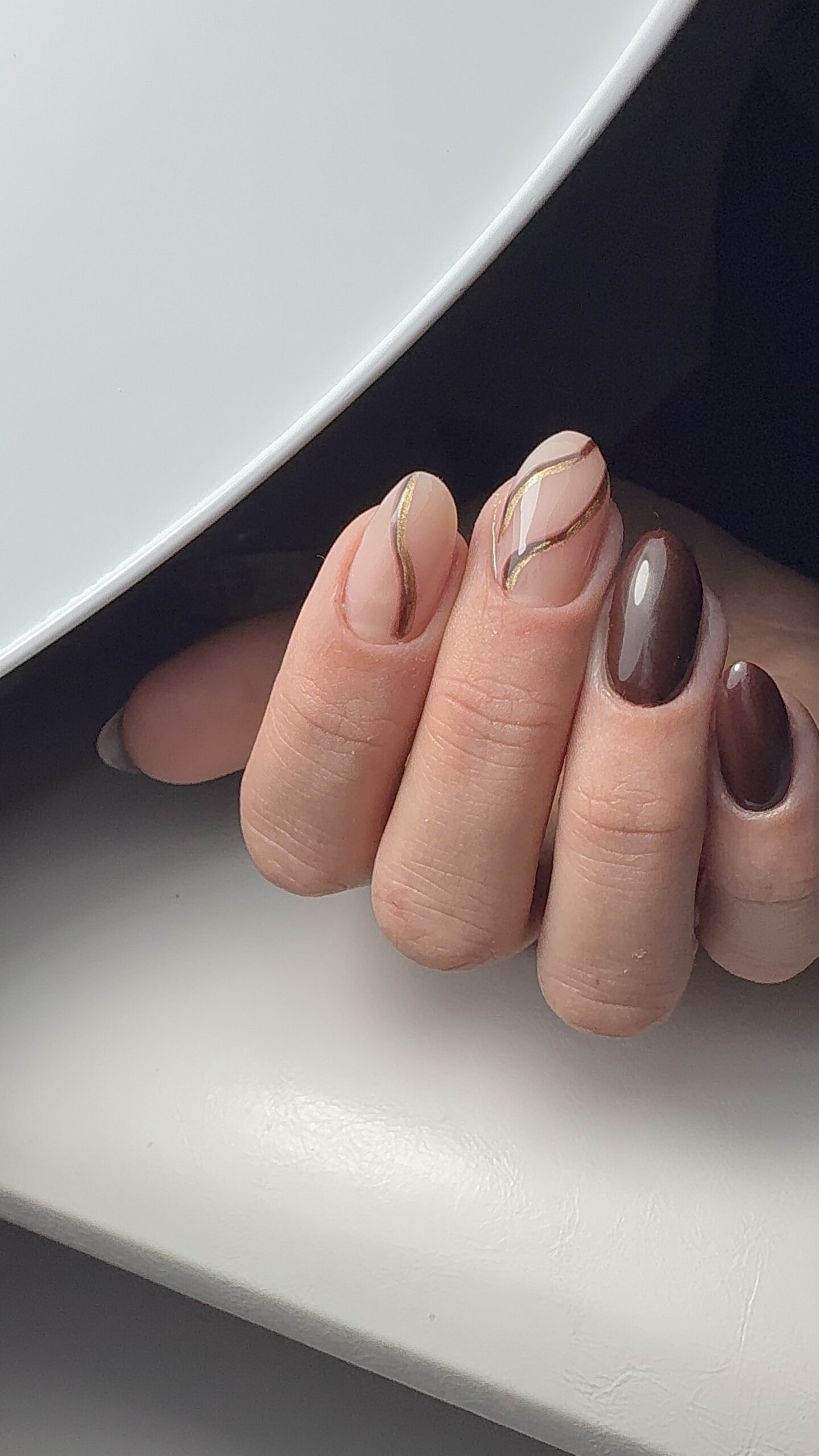 remplissage gel clermont ferrand