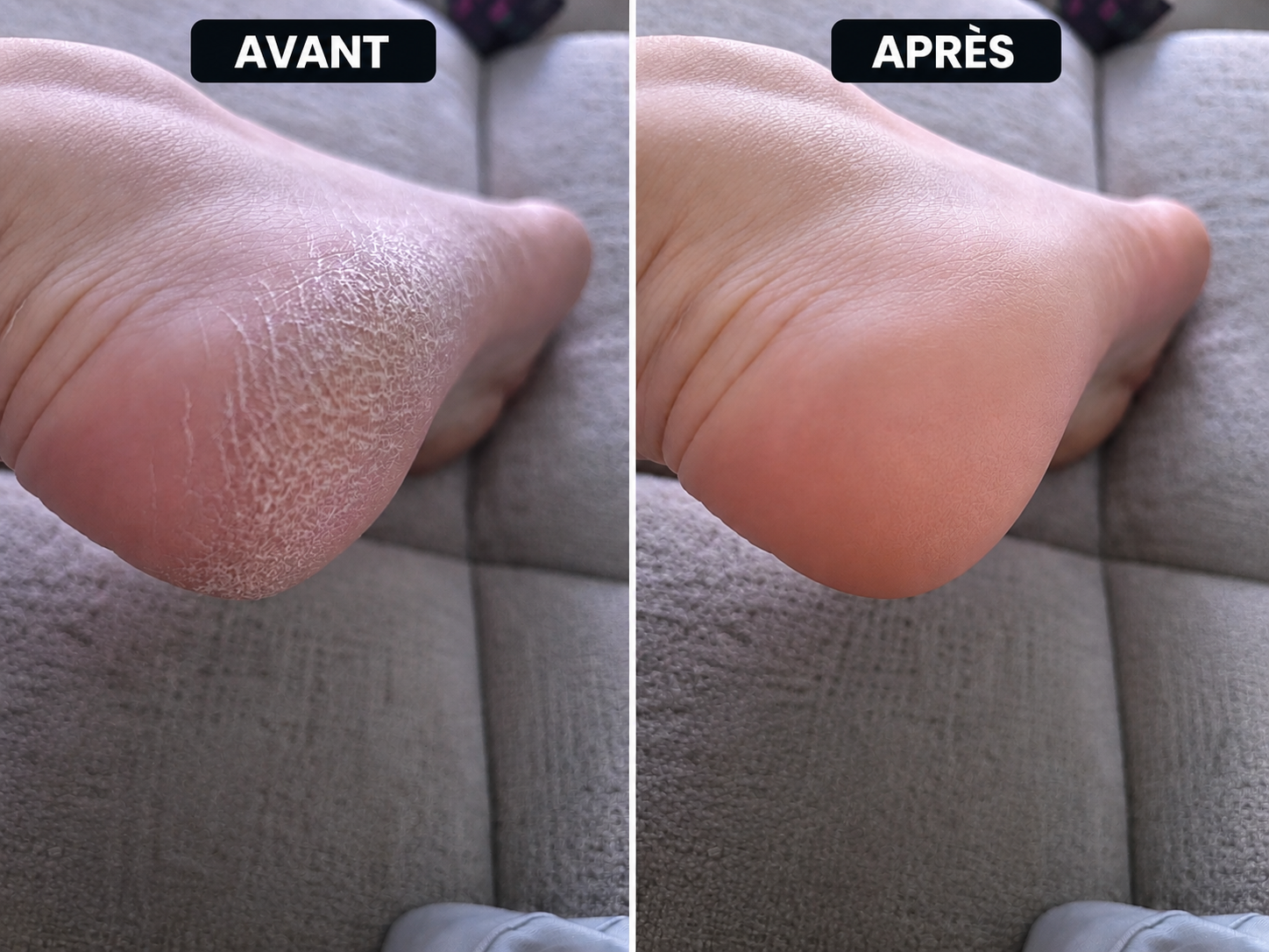 Pédicure russe soin des pieds Aubière Clermont-Ferrand